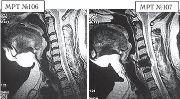 Иллюстрация к книге — Остеохондроз для профессионального пациента [i_122.jpg]