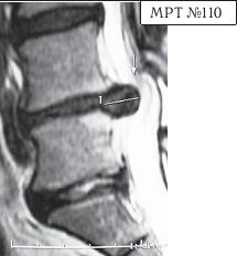 Иллюстрация к книге — Остеохондроз для профессионального пациента [i_124.jpg]