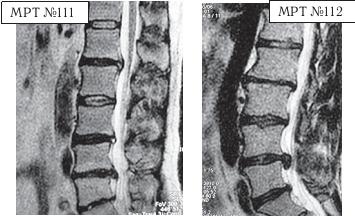 Иллюстрация к книге — Остеохондроз для профессионального пациента [i_125.jpg]