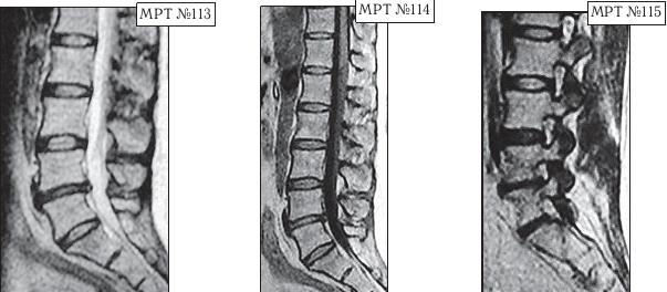 Иллюстрация к книге — Остеохондроз для профессионального пациента [i_126.jpg]
