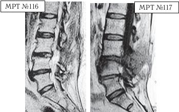 Иллюстрация к книге — Остеохондроз для профессионального пациента [i_127.jpg]