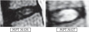 Иллюстрация к книге — Остеохондроз для профессионального пациента [i_137.jpg]