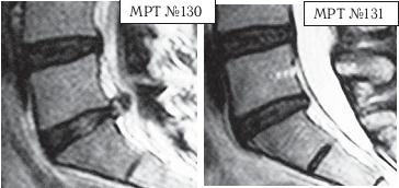 Иллюстрация к книге — Остеохондроз для профессионального пациента [i_139.jpg]