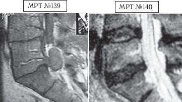 Иллюстрация к книге — Остеохондроз для профессионального пациента [i_143.jpg]