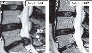 Иллюстрация к книге — Остеохондроз для профессионального пациента [i_144.jpg]
