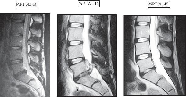 Иллюстрация к книге — Остеохондроз для профессионального пациента [i_145.jpg]