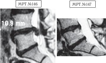 Иллюстрация к книге — Остеохондроз для профессионального пациента [i_146.jpg]