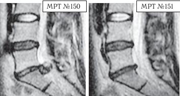 Иллюстрация к книге — Остеохондроз для профессионального пациента [i_148.jpg]