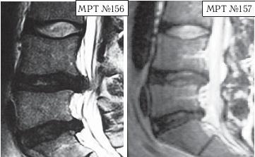 Иллюстрация к книге — Остеохондроз для профессионального пациента [i_151.jpg]