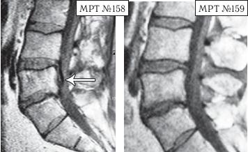 Иллюстрация к книге — Остеохондроз для профессионального пациента [i_152.jpg]