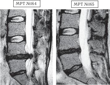 Иллюстрация к книге — Остеохондроз для профессионального пациента [i_155.jpg]