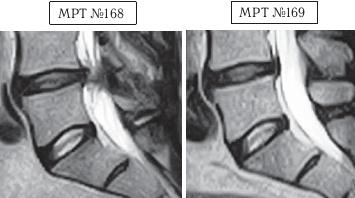 Иллюстрация к книге — Остеохондроз для профессионального пациента [i_157.jpg]