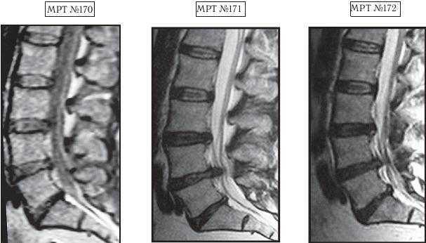 Иллюстрация к книге — Остеохондроз для профессионального пациента [i_158.jpg]