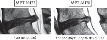 Иллюстрация к книге — Остеохондроз для профессионального пациента [i_161.jpg]