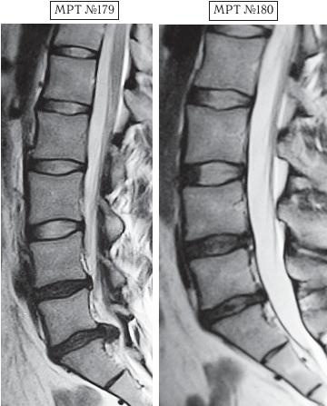 Иллюстрация к книге — Остеохондроз для профессионального пациента [i_162.jpg]