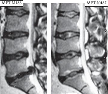 Иллюстрация к книге — Остеохондроз для профессионального пациента [i_166.jpg]