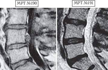 Иллюстрация к книге — Остеохондроз для профессионального пациента [i_168.jpg]
