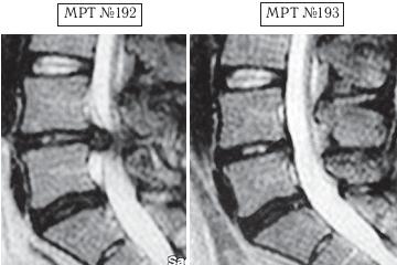 Иллюстрация к книге — Остеохондроз для профессионального пациента [i_169.jpg]