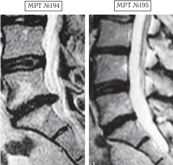 Иллюстрация к книге — Остеохондроз для профессионального пациента [i_170.jpg]