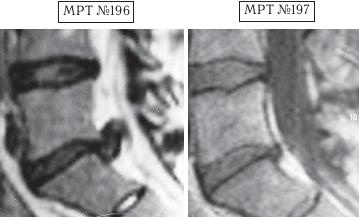 Иллюстрация к книге — Остеохондроз для профессионального пациента [i_171.jpg]