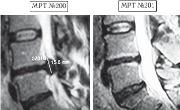 Иллюстрация к книге — Остеохондроз для профессионального пациента [i_173.jpg]