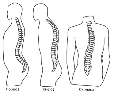 Иллюстрация к книге — Остеохондроз. Как победить боль [i_005.jpg]