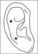 Иллюстрация к книге — Остеохондроз. Как победить боль [i_050.jpg]