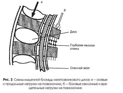 Иллюстрация к книге — Новый взгляд на остеохондроз. Причины и лечение [i_003.jpg]