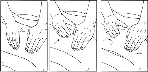 Иллюстрация к книге — Массаж и лечебная физкультура [i_048.jpg]