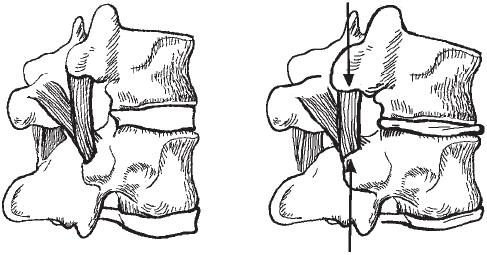 Иллюстрация к книге — Первая скрипка позвоночника. Революционная методика лечения остеохондроза [_20.jpg]