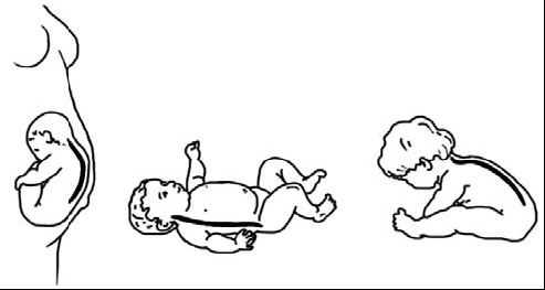 Иллюстрация к книге — Первая скрипка позвоночника. Революционная методика лечения остеохондроза [_53.jpg]