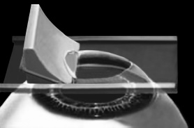 Иллюстрация к книге — Лазерная коррекция зрения [i_003.jpg]