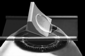 Иллюстрация к книге — Лазерная коррекция зрения [i_004.jpg]