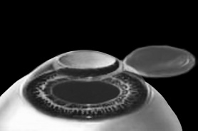 Иллюстрация к книге — Лазерная коррекция зрения [i_007.jpg]