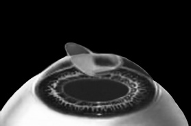 Иллюстрация к книге — Лазерная коррекция зрения [i_008.jpg]