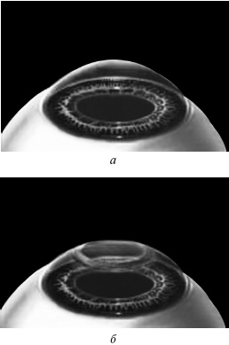 Иллюстрация к книге — Лазерная коррекция зрения [i_009.jpg]