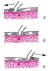 Иллюстрация к книге — Атлас профессионального массажа [i_047.jpg]