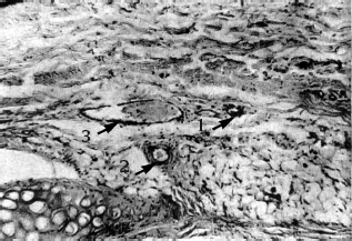 Иллюстрация к книге — Атлас профессионального массажа [i_206.jpg]