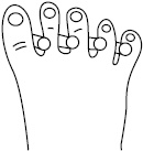 Иллюстрация к книге — Плоскостопие. Самые эффективные методы лечения [Autogen_eBook_id24.jpg]