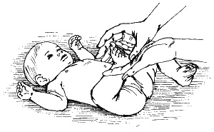 Иллюстрация к книге — Детский массаж. Поэтапное руководство [i_047.jpg]