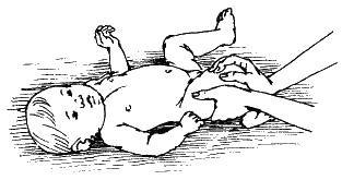 Иллюстрация к книге — Детский массаж. Поэтапное руководство [i_068.jpg]