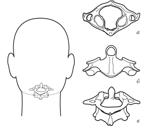 Иллюстрация к книге — Остеохондроз [Autogen_eBook_id2.jpg]
