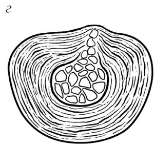 Иллюстрация к книге — Остеохондроз [Autogen_eBook_id21.jpg]