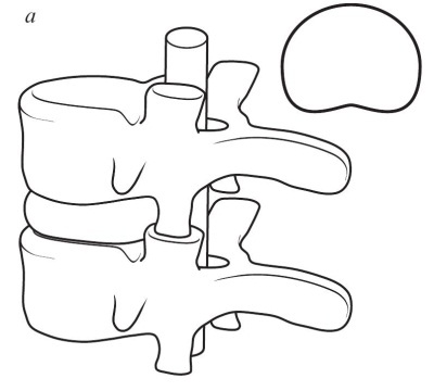 Иллюстрация к книге — Остеохондроз [Autogen_eBook_id24.jpg]