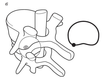 Иллюстрация к книге — Остеохондроз [Autogen_eBook_id26.jpg]