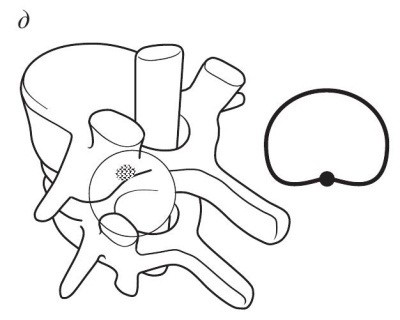 Иллюстрация к книге — Остеохондроз [Autogen_eBook_id28.jpg]