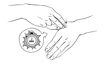 Иллюстрация к книге — 120 на 80. Книга о том, как победить гипертонию, а не снижать давление [Autogen_eBook_id65.jpg]