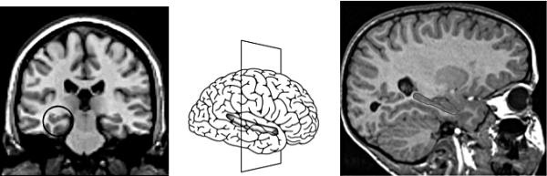 Иллюстрация к книге — Антимозг. Цифровые технологии и мозг [i_005.jpg]