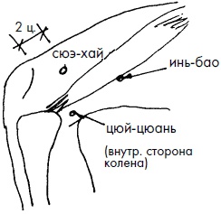 Иллюстрация к книге — 700 китайских упражнений для лечения и предотвращения 100 болезней [Autogen_eBook_id157.jpg]