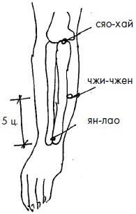 Иллюстрация к книге — 700 китайских упражнений для лечения и предотвращения 100 болезней [Autogen_eBook_id160.jpg]